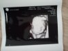 20 weken echo Baby Maart (2).jpg