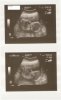 derde echo baby..2012 002.jpg