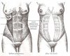 buikspieren-diastase-aspx.jpg