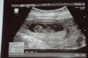 echo 22-10-2012.jpg