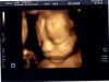 24 w 3 d 3 D echo 22 Oktober 2012 (1).jpg