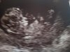 20170403_200953.jpg