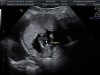 IMG-20170404-WA0021.jpg