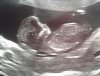 echo11w6d.jpg