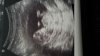 IMG-20170405-WA0003.jpg
