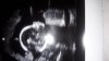 IMG-20170318-WA0039.jpg