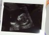 babyxxx.jpg