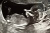 baby24-4-2017.jpg