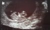 Echo 9 wk + 1 24-4-2017.jpg