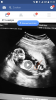 babyechomeidjongen.png