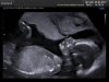 20 WEKEN ECHO_0014.JPG