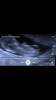 Screenshot_2017-04-28-11-26-03.png