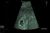 20170428_203931.jpg