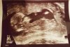 IMG-20170502-WA0003.jpg