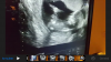 IMG_1919 (1).PNG