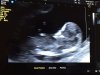 IMG-20170530-WA0002.jpg