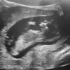 Baby (2).jpg