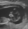 Baby5 (3).jpg