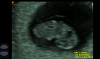 20170607_065622.png
