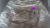 20170610_102131.jpg