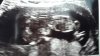 20170613_122939.jpg