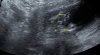 IMG_20170602_1_3.jpg