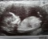 20170617_145809.jpg
