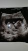 IMG-20170622-WA0005.jpeg
