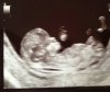 IMG-20170705-WA0017-1-1.jpg