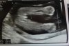 Geslacht baby x.jpg