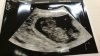 IMG-20170717-WA0003.jpeg