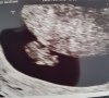 20170719_141316.jpg
