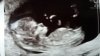 IMG-20170808-WA0002.jpeg