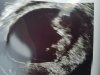 20170809_133641.jpg