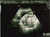 Echo 3 25-10-2012.jpg