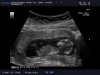 BABY-_JAGGOE_20121025_ABD-_1ST-_TRIM_0009.jpg