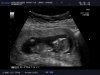 BABY-_JAGGOE_20121025_ABD-_1ST-_TRIM_0008.jpg