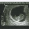 Baby 2.0 - 9 weken.jpg