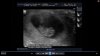echo1 5-11-12.jpg