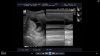 echo1 5-11-12b.jpg