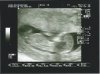 5-11-12 echo 4.jpg
