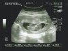 5-11-12 echo 5.jpg