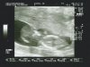 5-11-12 echo 6.jpg