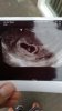 IMG-20170811-WA0022.jpeg