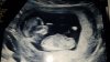 IMG-20170810-WA0006.jpeg
