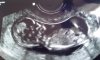 IMG-20170726-WA0000.jpeg