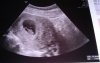 IMG-20170814-WA0004~2.jpeg