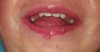 20170814_184355.jpg