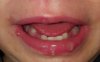 20170815_072125.jpg