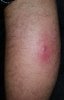 20170822_062606.jpg